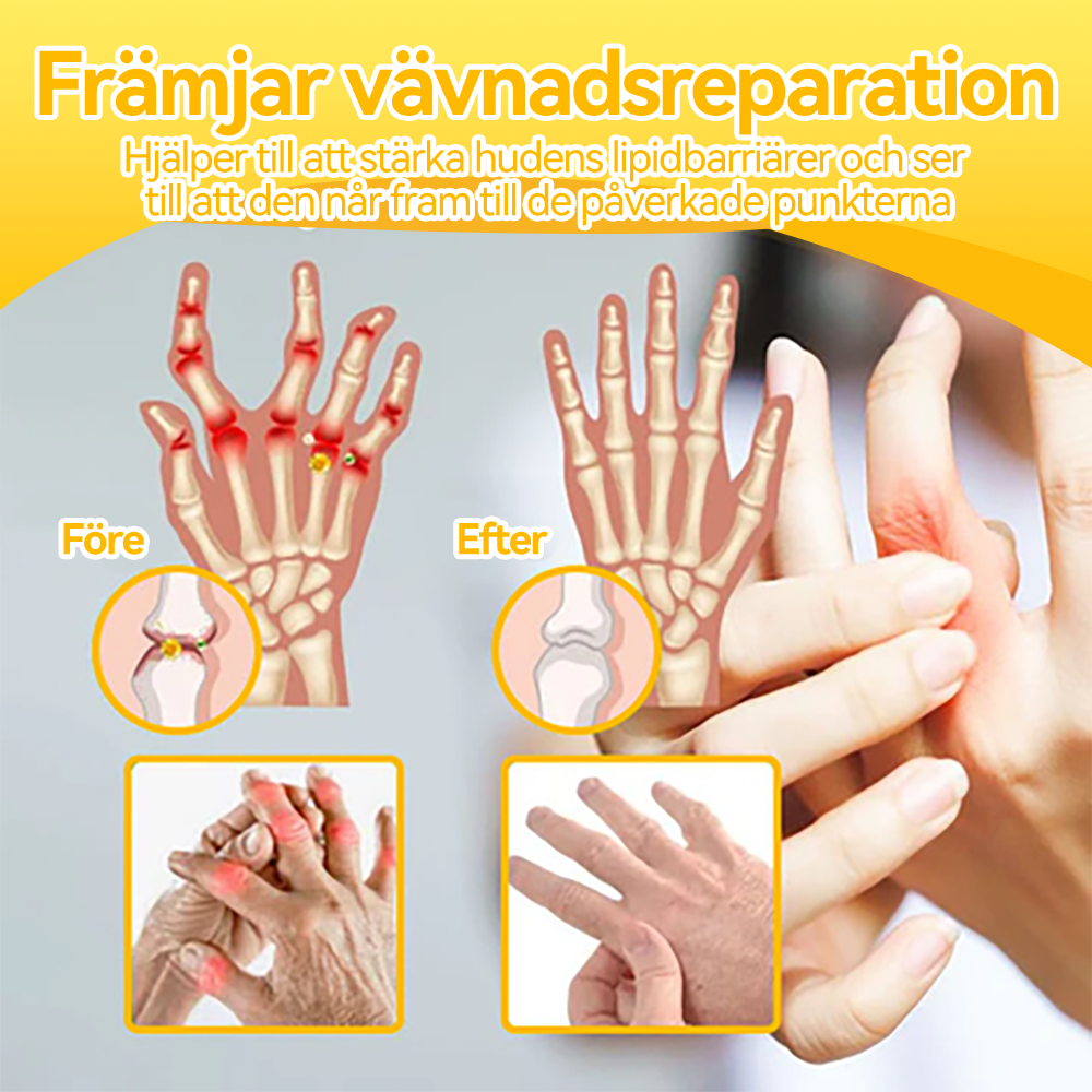 𝐎𝐲𝐢𝐤𝐞𝐲®𝐁𝐨𝐭𝐮𝐥𝐢𝐧𝐮𝐦𝐭𝐨𝐱𝐢𝐧 & 𝐁𝐢𝐞𝐧𝐞𝐧𝐠𝐢𝐟𝐭 𝐒𝐜𝐡𝐦𝐞𝐫𝐳𝐥𝐢𝐧𝐝𝐞𝐫𝐮𝐧𝐠 𝐊𝐧𝐨𝐜𝐡𝐞𝐧𝐡𝐞𝐢𝐥𝐞𝐧𝐝𝐞 𝐂𝐫𝐞𝐦𝐞🌼💖