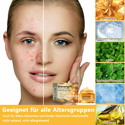 🔥 Nur noch 6 Boxen übrig! Extra 50% Rabatt! Dermatologisch getestet, 4-6 Sticks reichen aus, um Ihre Haut vollständig zu reparieren, ohne dass es zu Hautreizungen kommt. Verpassen Sie es nicht und warten Sie nicht ein weiteres Jahr! 💥