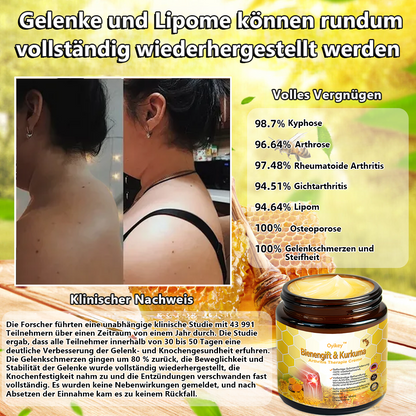 𝐎𝐲𝐢𝐤𝐞𝐲™ 𝐁𝐢𝐞𝐧𝐞𝐧𝐠𝐢𝐟𝐭 & 𝐊𝐮𝐫𝐤𝐮𝐦𝐚 𝐀𝐫𝐭𝐡𝐫𝐢𝐭𝐢𝐬 𝐓𝐡𝐞𝐫𝐚𝐩𝐢𝐞 𝐂𝐫𝐞𝐦𝐞🦓(𝐒𝐩𝐞𝐳𝐢𝐞𝐥𝐥 𝐟ü𝐫 ä𝐥𝐭𝐞𝐫𝐞 𝐄𝐫𝐰𝐚𝐜𝐡𝐬𝐞𝐧𝐞 & 𝐀𝐀𝐎𝐒 𝐞𝐦𝐩𝐟𝐢𝐞𝐡𝐥𝐭) (Copy)