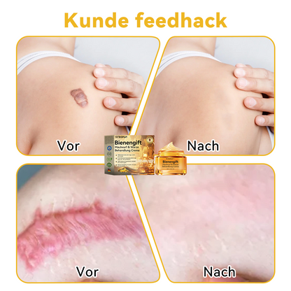 🔥 Nur noch 6 Boxen übrig! Extra 50% Rabatt! Dermatologisch getestet, 4-6 Sticks reichen aus, um Ihre Haut vollständig zu reparieren, ohne dass es zu Hautreizungen kommt. Verpassen Sie es nicht und warten Sie nicht ein weiteres Jahr! 💥