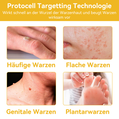 🔥 Nur noch 6 Boxen übrig! Extra 50% Rabatt! Dermatologisch getestet, 4-6 Sticks reichen aus, um Ihre Haut vollständig zu reparieren, ohne dass es zu Hautreizungen kommt. Verpassen Sie es nicht und warten Sie nicht ein weiteres Jahr! 💥