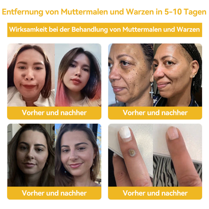 🔥 Nur noch 6 Boxen übrig! Extra 50% Rabatt! Dermatologisch getestet, 4-6 Sticks reichen aus, um Ihre Haut vollständig zu reparieren, ohne dass es zu Hautreizungen kommt. Verpassen Sie es nicht und warten Sie nicht ein weiteres Jahr! 💥