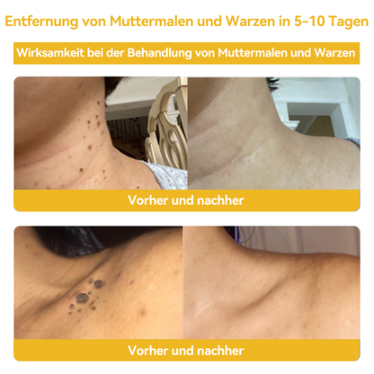 🔥 Nur noch 6 Boxen übrig! Extra 50% Rabatt! Dermatologisch getestet, 4-6 Sticks reichen aus, um Ihre Haut vollständig zu reparieren, ohne dass es zu Hautreizungen kommt. Verpassen Sie es nicht und warten Sie nicht ein weiteres Jahr! 💥
