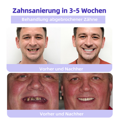 Offizieller Shop | Ourlyard™ Zahnfleischreparatur und Mundgesundheits-Mineralpulver🧑🏽‍⚕️Erhalten Sie die CE-Zertifizierung (Behandlung von Parodontitis und Mundgeschwüren, Vorbeugung von Zahnverlust und Reparatur von Zahnfleischrückgang)🎄