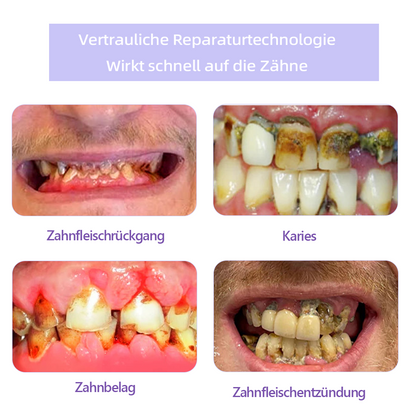 Offizieller Shop | Ourlyard™ Zahnfleischreparatur und Mundgesundheits-Mineralpulver🧑🏽‍⚕️Erhalten Sie die CE-Zertifizierung (Behandlung von Parodontitis und Mundgeschwüren, Vorbeugung von Zahnverlust und Reparatur von Zahnfleischrückgang)🎄
