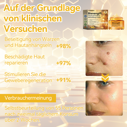 🔥 Nur noch 6 Boxen übrig! Extra 50% Rabatt! Dermatologisch getestet, 4-6 Sticks reichen aus, um Ihre Haut vollständig zu reparieren, ohne dass es zu Hautreizungen kommt. Verpassen Sie es nicht und warten Sie nicht ein weiteres Jahr! 💥