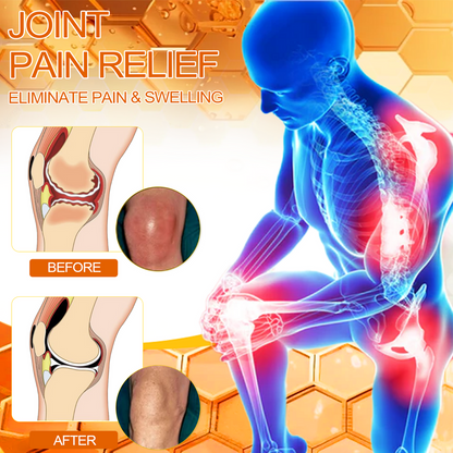 Offizieller Shop: Aetheris™ Bee Venom Arthritis Therapy Cream(Speziell für ältere Erwachsene & AAOS empfiehlt)Last day promotion 70% off🔥🔥