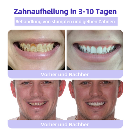 Offizieller Shop | Ourlyard™ Zahnfleischreparatur und Mundgesundheits-Mineralpulver🧑🏽‍⚕️Erhalten Sie die CE-Zertifizierung (Behandlung von Parodontitis und Mundgeschwüren, Vorbeugung von Zahnverlust und Reparatur von Zahnfleischrückgang)🎄