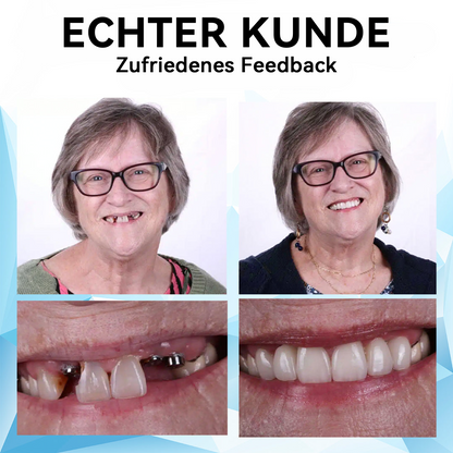 𝐁𝐢𝐤𝐞𝐧𝐝𝐚™ 𝐒𝐢𝐥𝐢𝐤𝐨𝐧 𝐑𝐞𝐥𝐢𝐧𝐞 𝐃𝐞𝐧𝐭𝐮𝐫𝐞 𝐒𝐞𝐭𝐳𝐞𝐧🦷✅ (⏰𝐙𝐞𝐢𝐭𝐥𝐢𝐜𝐡 𝐛𝐞𝐠𝐫𝐞𝐧𝐳𝐭𝐞𝐫 𝐑𝐚𝐛𝐚𝐭𝐭 𝐋𝐞𝐭𝐳𝐭𝐞 𝟑𝟎 𝐌𝐢𝐧𝐮𝐭𝐞𝐧⏰)