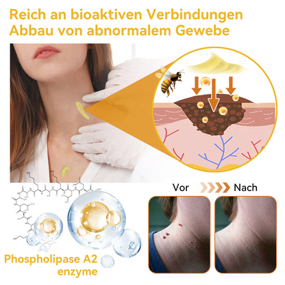 🔥 Nur noch 6 Boxen übrig! Extra 50% Rabatt! Dermatologisch getestet, 4-6 Sticks reichen aus, um Ihre Haut vollständig zu reparieren, ohne dass es zu Hautreizungen kommt. Verpassen Sie es nicht und warten Sie nicht ein weiteres Jahr! 💥