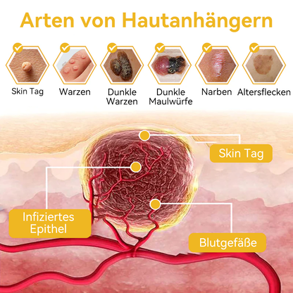 🔥 Nur noch 6 Boxen übrig! Extra 50% Rabatt! Dermatologisch getestet, 4-6 Sticks reichen aus, um Ihre Haut vollständig zu reparieren, ohne dass es zu Hautreizungen kommt. Verpassen Sie es nicht und warten Sie nicht ein weiteres Jahr! 💥