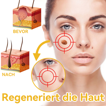 🔥 Nur noch 6 Boxen übrig! Extra 50% Rabatt! Dermatologisch getestet, 4-6 Sticks reichen aus, um Ihre Haut vollständig zu reparieren, ohne dass es zu Hautreizungen kommt. Verpassen Sie es nicht und warten Sie nicht ein weiteres Jahr! 💥