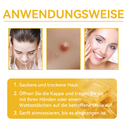 🔥 Nur noch 6 Boxen übrig! Extra 50% Rabatt! Dermatologisch getestet, 4-6 Sticks reichen aus, um Ihre Haut vollständig zu reparieren, ohne dass es zu Hautreizungen kommt. Verpassen Sie es nicht und warten Sie nicht ein weiteres Jahr! 💥