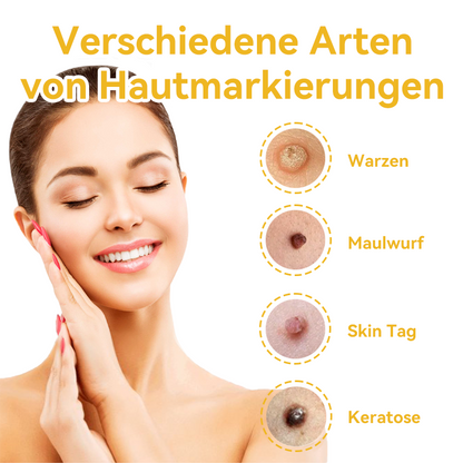🔥 Nur noch 6 Boxen übrig! Extra 50% Rabatt! Dermatologisch getestet, 4-6 Sticks reichen aus, um Ihre Haut vollständig zu reparieren, ohne dass es zu Hautreizungen kommt. Verpassen Sie es nicht und warten Sie nicht ein weiteres Jahr! 💥