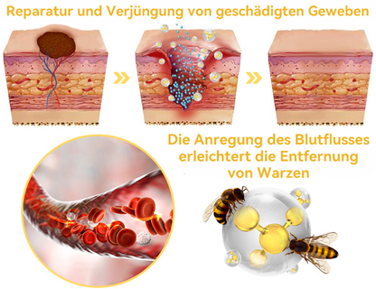 🔥 Nur noch 6 Boxen übrig! Extra 50% Rabatt! Dermatologisch getestet, 4-6 Sticks reichen aus, um Ihre Haut vollständig zu reparieren, ohne dass es zu Hautreizungen kommt. Verpassen Sie es nicht und warten Sie nicht ein weiteres Jahr! 💥