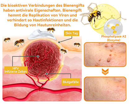 🔥 Nur noch 6 Boxen übrig! Extra 50% Rabatt! Dermatologisch getestet, 4-6 Sticks reichen aus, um Ihre Haut vollständig zu reparieren, ohne dass es zu Hautreizungen kommt. Verpassen Sie es nicht und warten Sie nicht ein weiteres Jahr! 💥