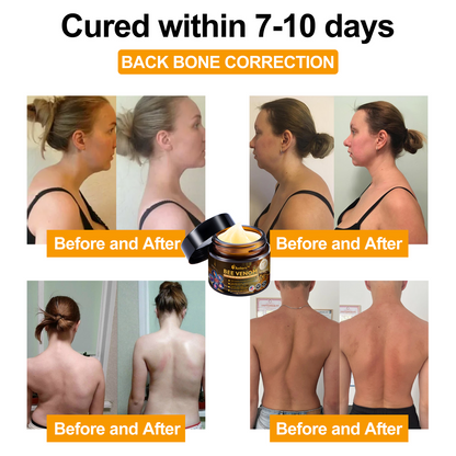 Offizieller Shop: Aetheris™ Bee Venom Arthritis Therapy Cream(Speziell für ältere Erwachsene & AAOS empfiehlt)Last day promotion 70% off🔥🔥