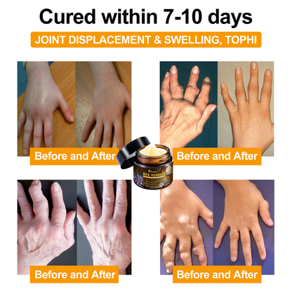 Offizieller Shop: Aetheris™ Bee Venom Arthritis Therapy Cream(Speziell für ältere Erwachsene & AAOS empfiehlt)Last day promotion 70% off🔥🔥
