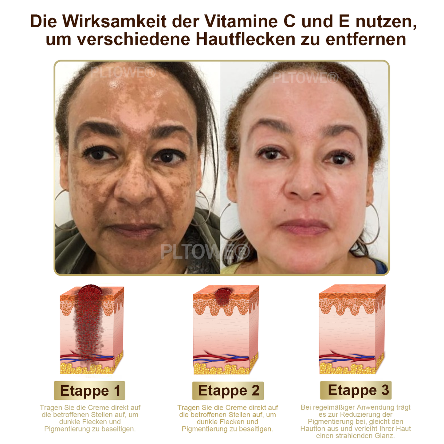 Dormorna™ leistungsstarke Ganzkörper-Hautpflegecreme