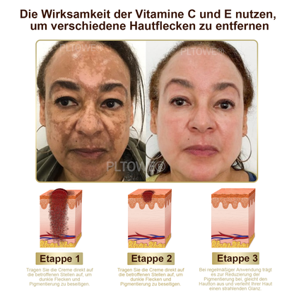 Dormorna™ leistungsstarke Ganzkörper-Hautpflegecreme