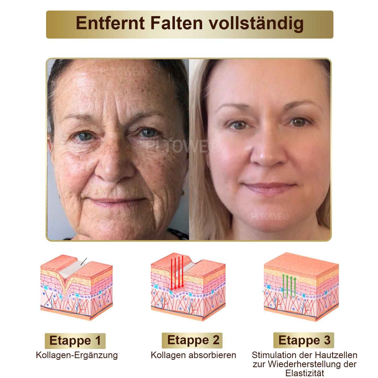 Dormorna™ leistungsstarke Ganzkörper-Hautpflegecreme