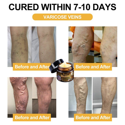 Offizieller Shop: Aetheris™ Bee Venom Arthritis Therapy Cream(Speziell für ältere Erwachsene & AAOS empfiehlt)Last day promotion 70% off🔥🔥