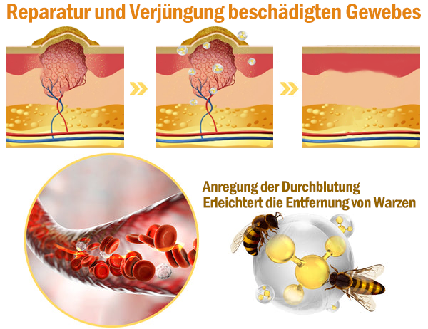 Dormorna™ leistungsstarke Ganzkörper-Hautpflegecreme